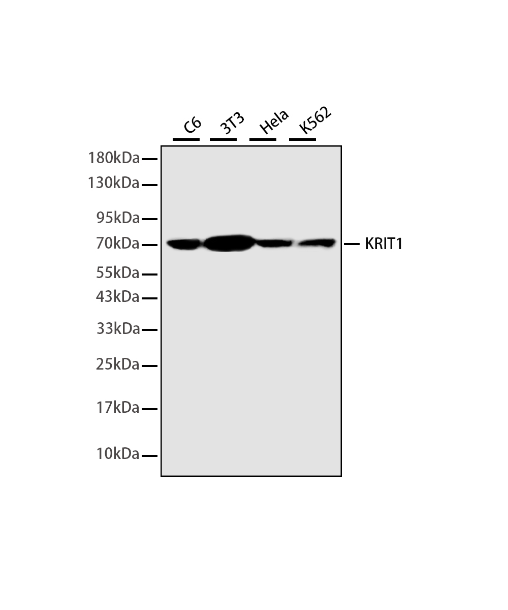 Rabbit monoclonal antibody