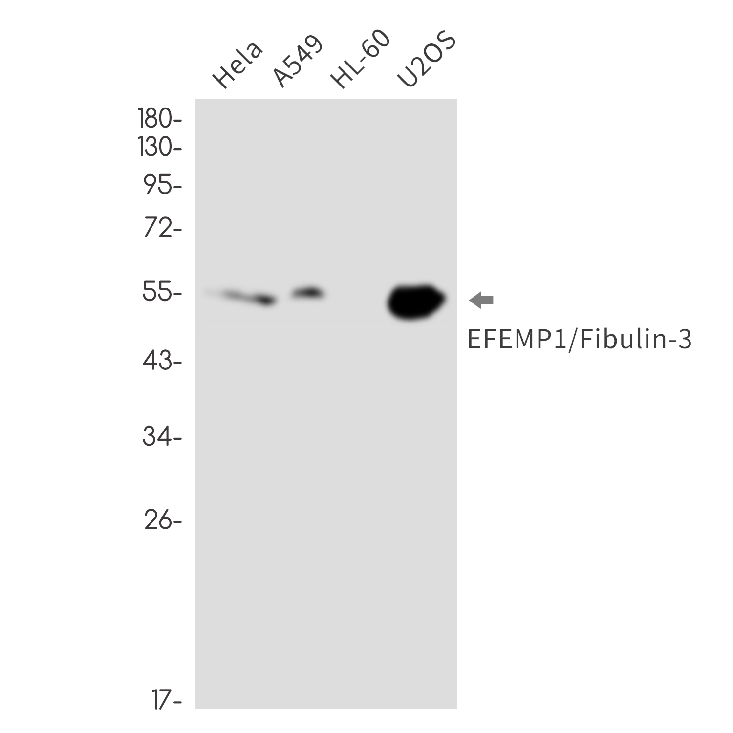 Rabbit monoclonal antibody