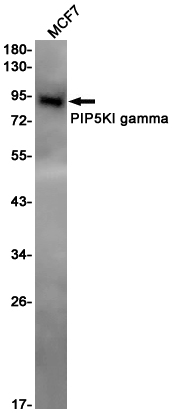 Rabbit monoclonal antibody