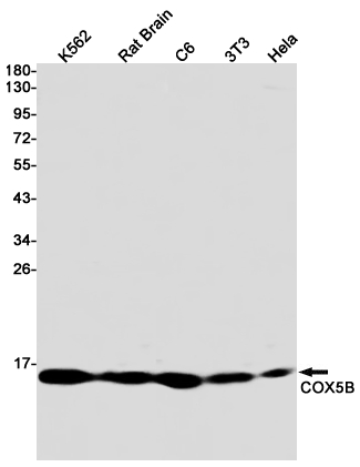 Rabbit monoclonal antibody