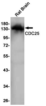 Rabbit monoclonal antibody