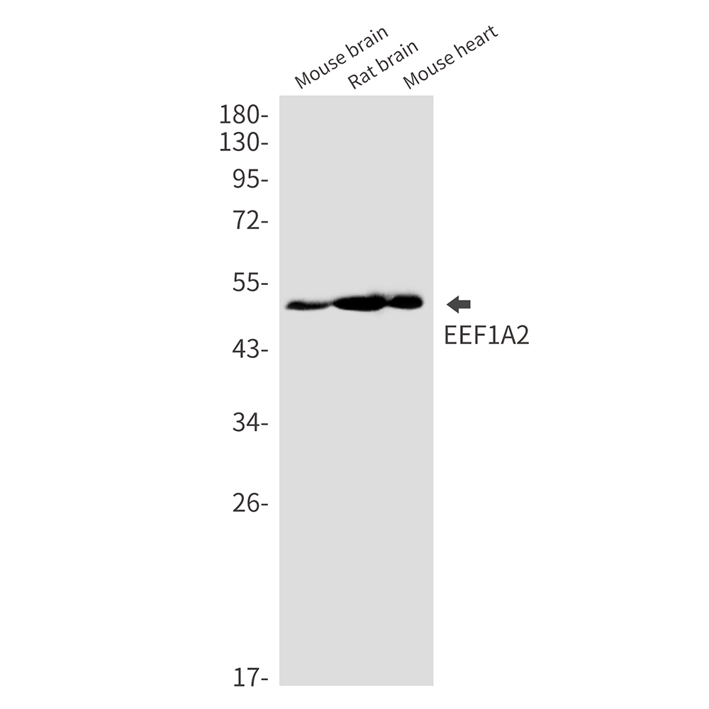 Rabbit monoclonal antibody
