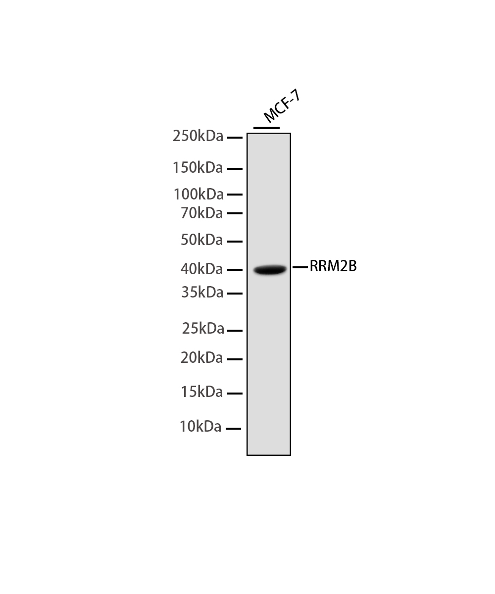 Rabbit monoclonal antibody