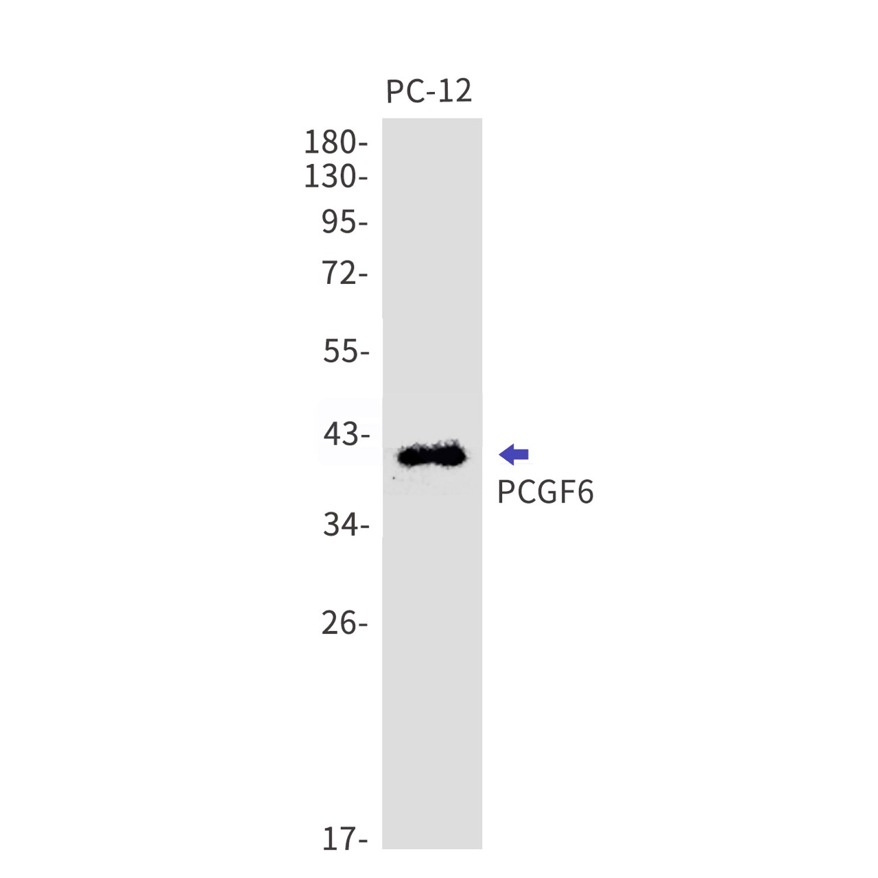 Rabbit monoclonal antibody