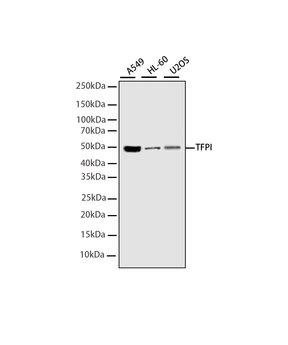 Rabbit monoclonal antibody