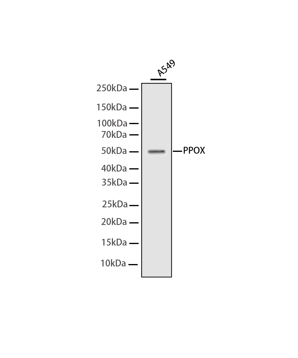 Rabbit monoclonal antibody