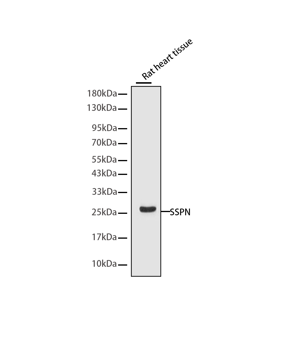 Rabbit monoclonal antibody