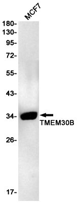 Rabbit monoclonal antibody