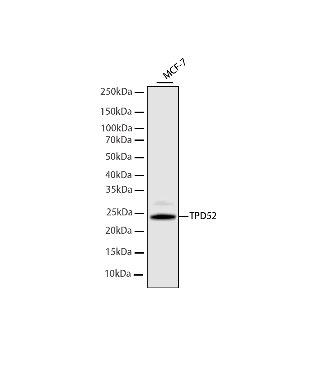 Rabbit monoclonal antibody