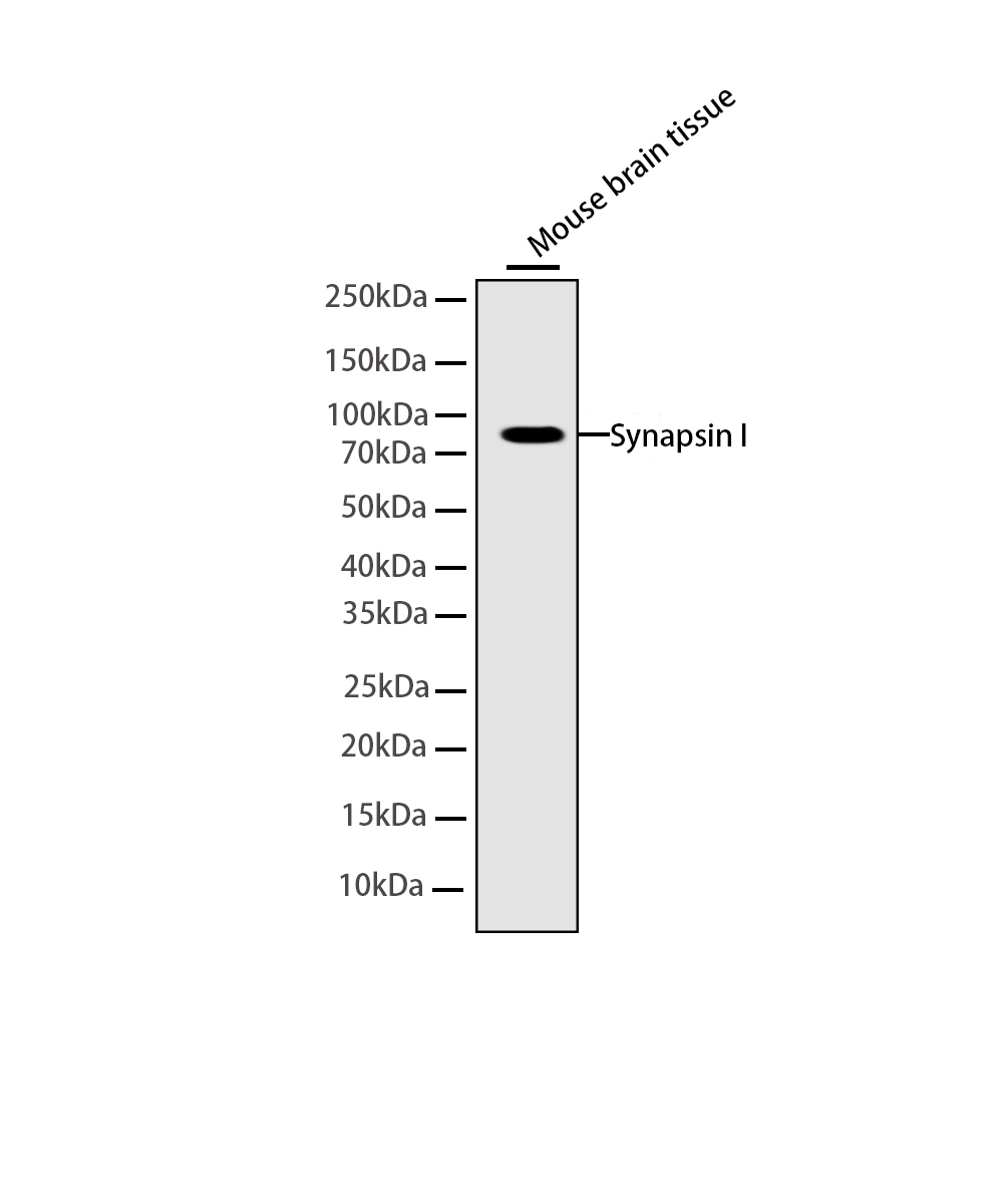 Rabbit monoclonal antibody