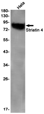 Rabbit monoclonal antibody