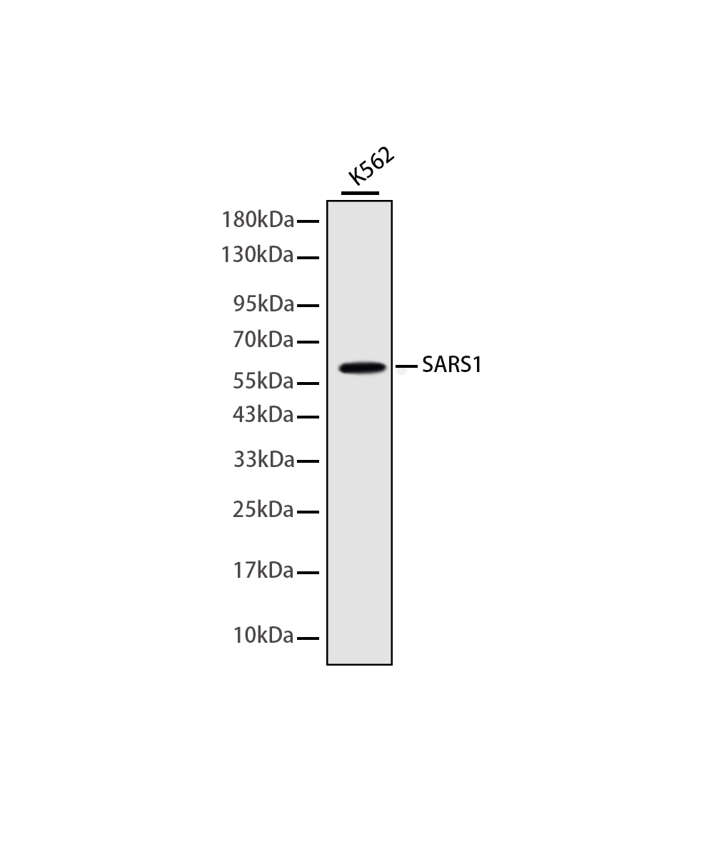 Rabbit monoclonal antibody