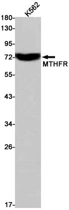 Rabbit monoclonal antibody