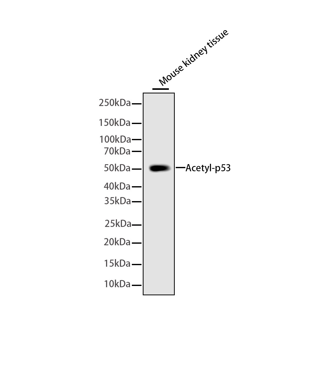 Rabbit monoclonal antibody