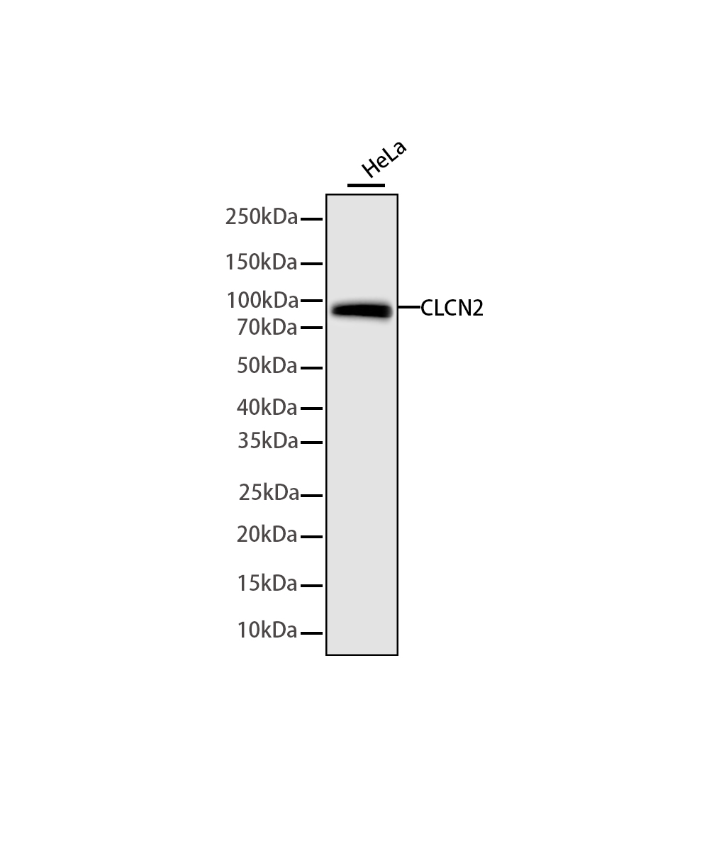 Rabbit monoclonal antibody