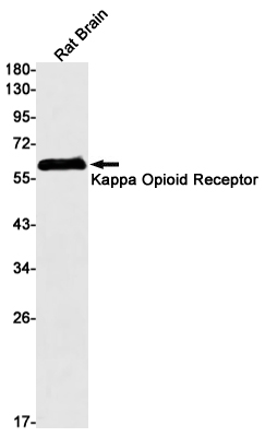 Rabbit monoclonal antibody