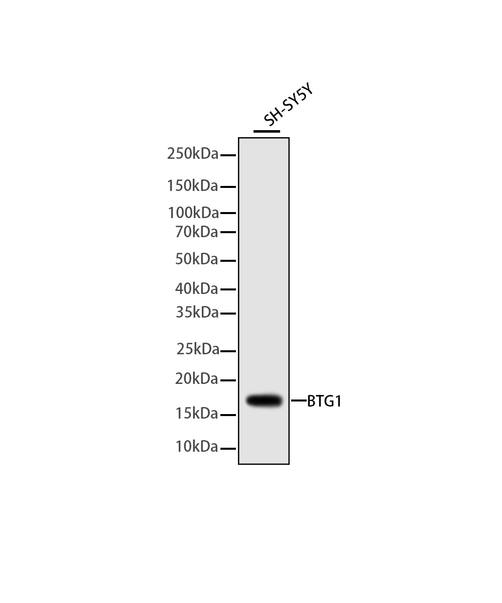 Rabbit monoclonal antibody