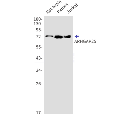 Rabbit monoclonal antibody