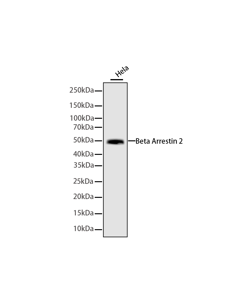 Rabbit monoclonal antibody