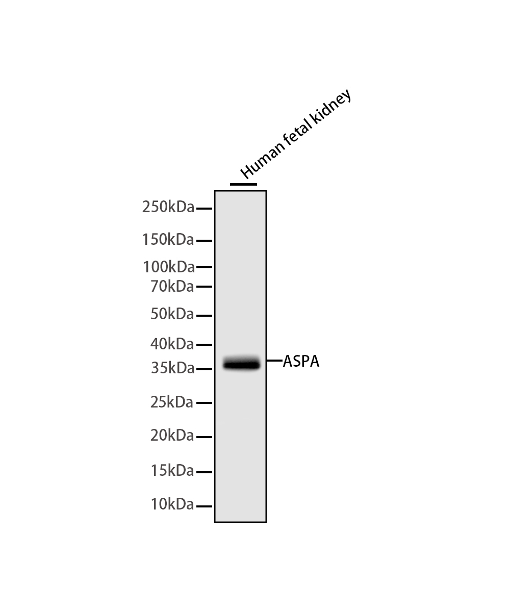 Rabbit monoclonal antibody