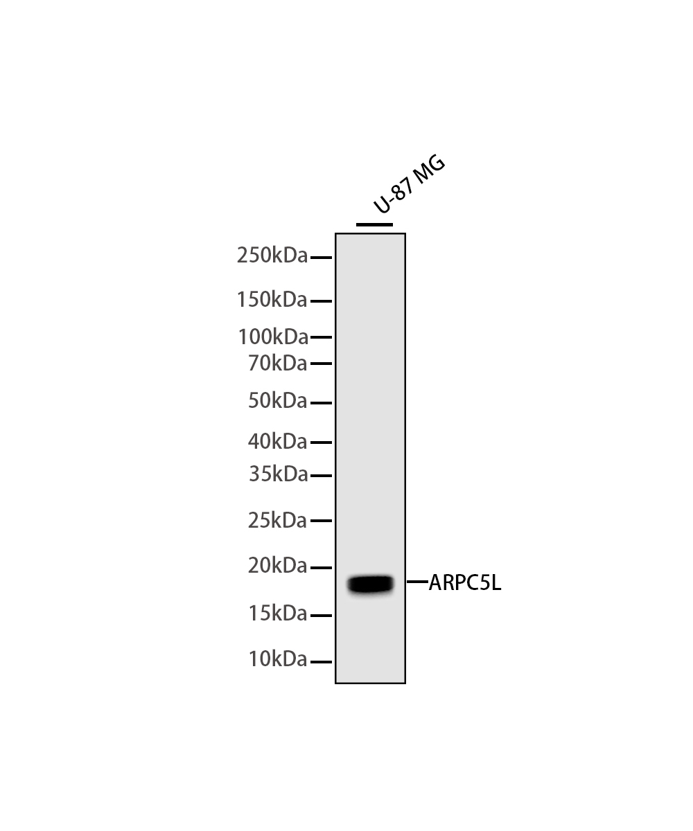 Rabbit monoclonal antibody