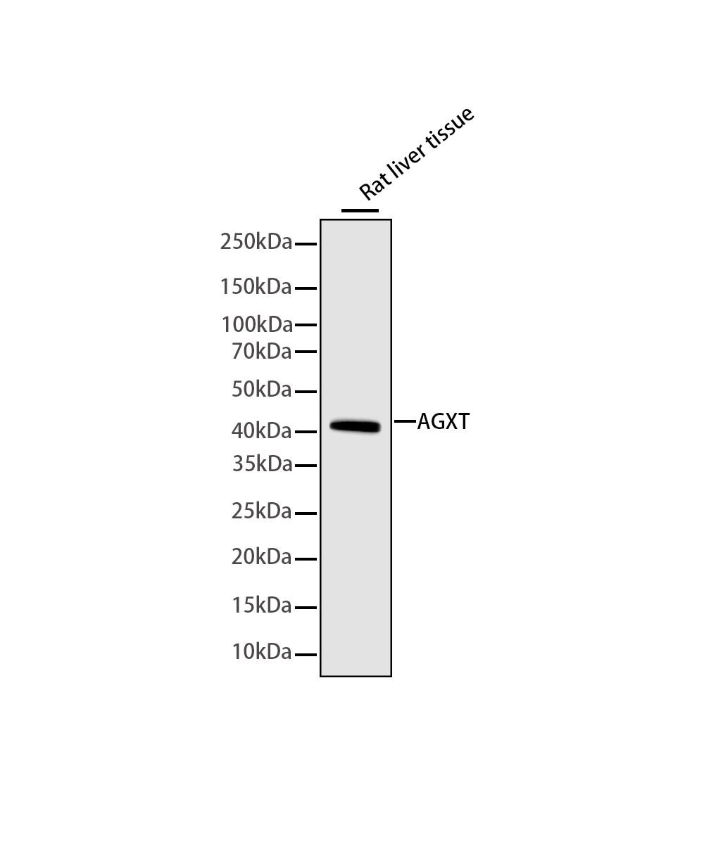Rabbit monoclonal antibody