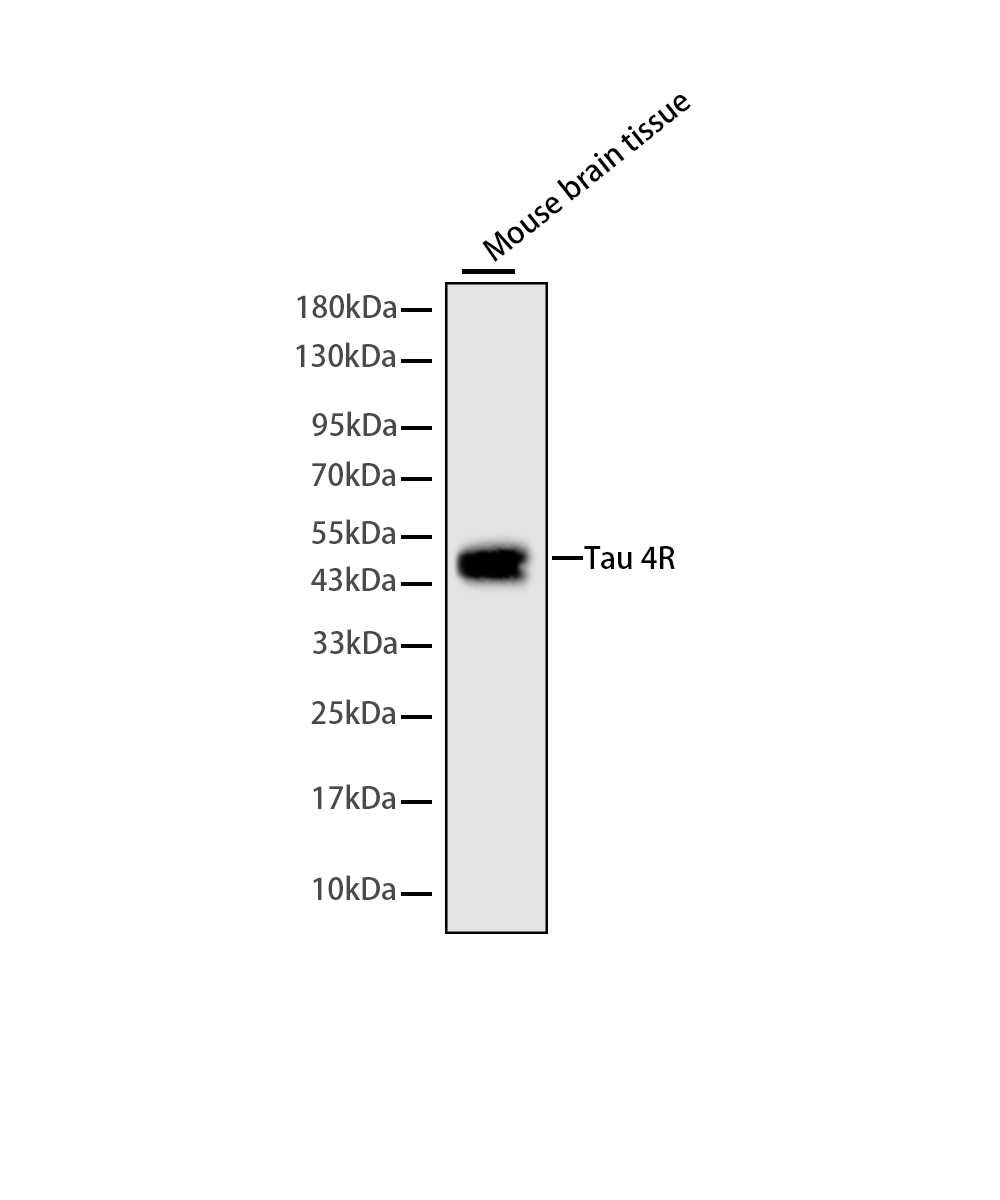 Rabbit monoclonal antibody