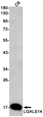Rabbit monoclonal antibody