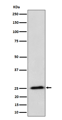 Rabbit monoclonal antibody