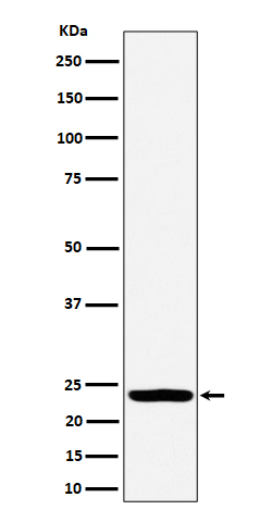 Rabbit monoclonal antibody