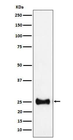 Rabbit monoclonal antibody