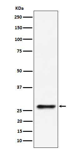 Rabbit monoclonal antibody