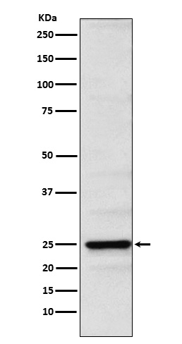 Rabbit monoclonal antibody