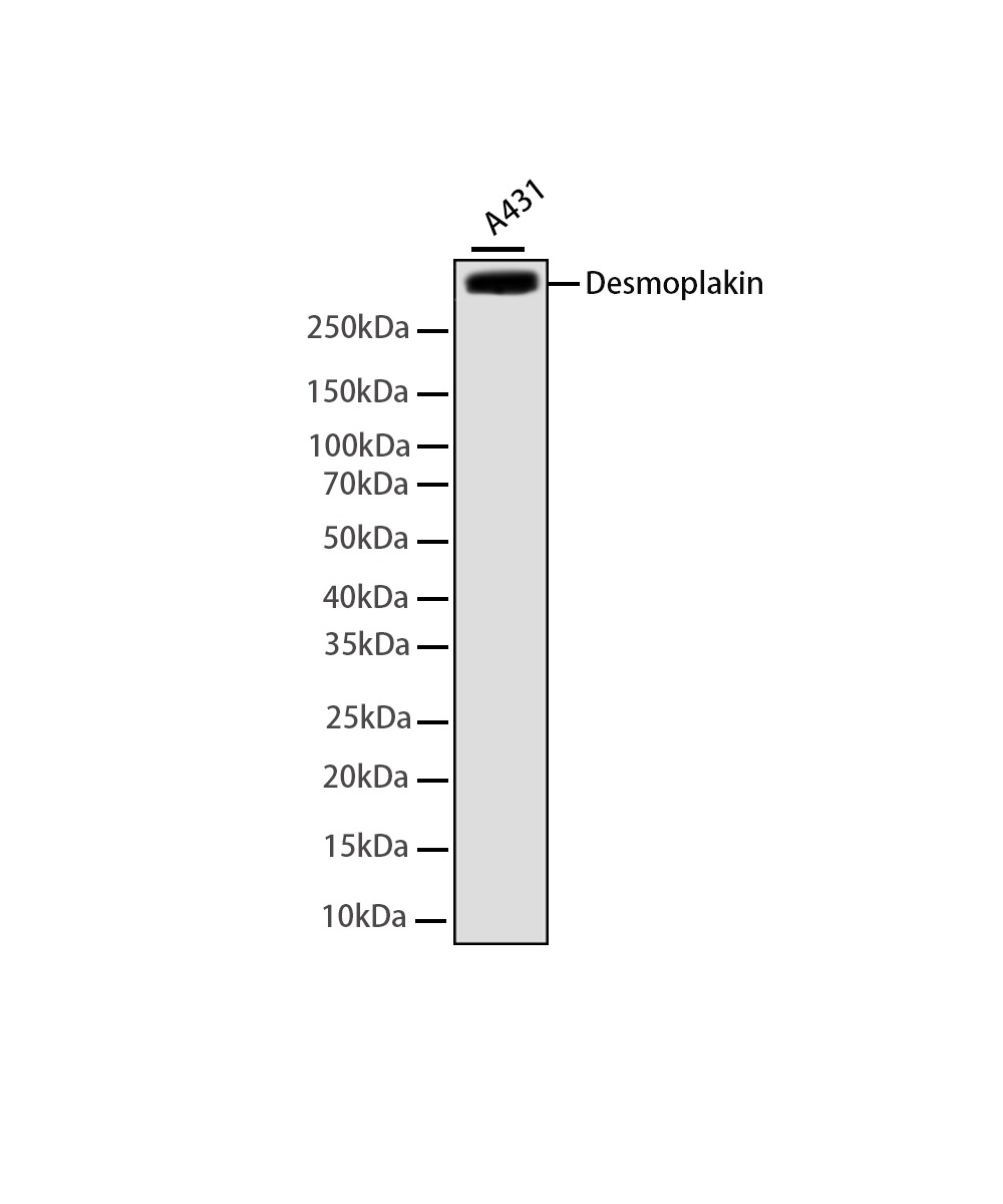 Rabbit monoclonal antibody
