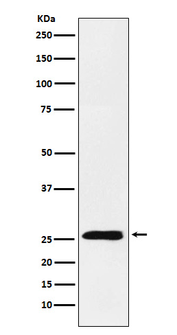 Rabbit monoclonal antibody