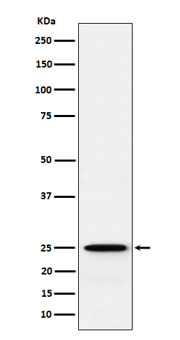 Rabbit monoclonal antibody