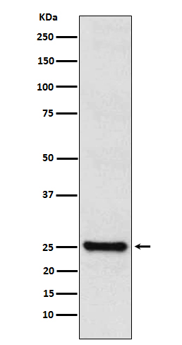 Rabbit monoclonal antibody