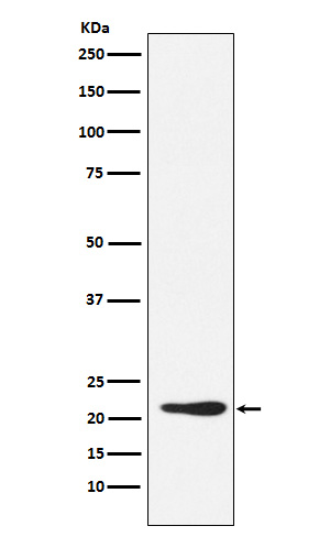 Rabbit monoclonal antibody