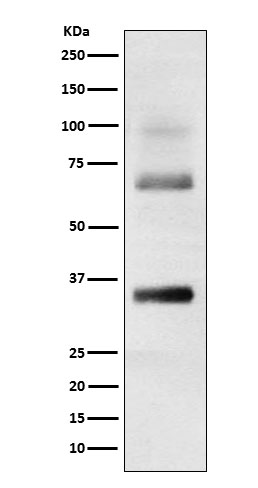 Rabbit monoclonal antibody