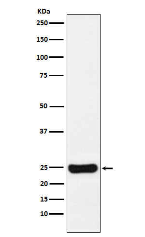 Rabbit monoclonal antibody