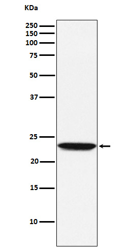Rabbit monoclonal antibody