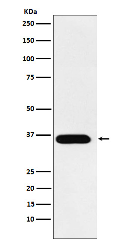 Rabbit monoclonal antibody