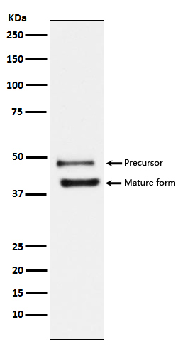 Rabbit monoclonal antibody