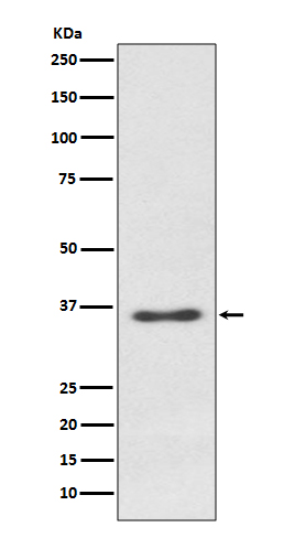 Rabbit monoclonal antibody
