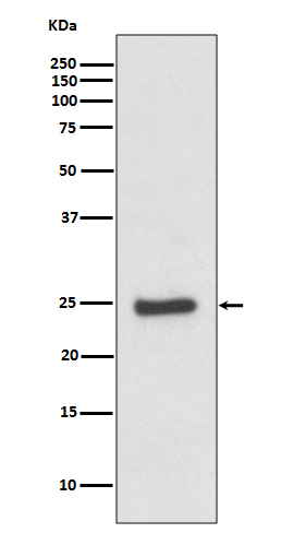 Rabbit monoclonal antibody