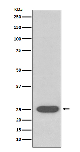 Rabbit monoclonal antibody