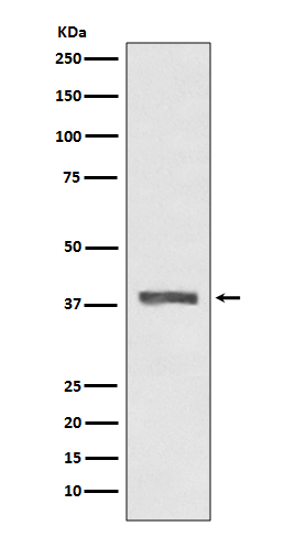 Rabbit monoclonal antibody