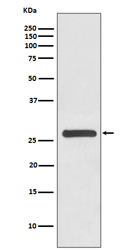 Rabbit monoclonal antibody