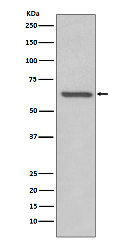 Rabbit monoclonal antibody