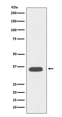 Rabbit monoclonal antibody